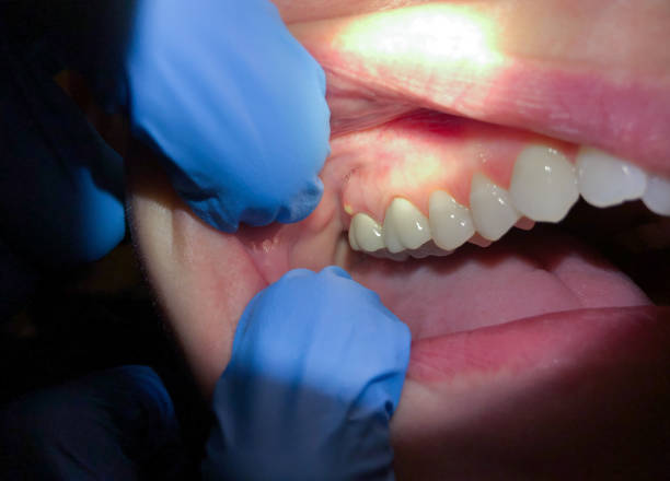 Best Emergency Dentist for Special Needs Patients in Ingleside, TX