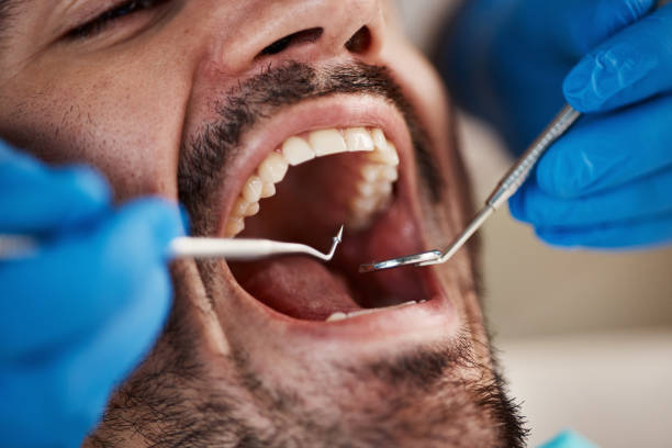 Best Mobile Emergency Dentist in Ingleside, TX